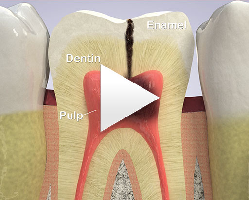 Dental Implants Burr Ridge
